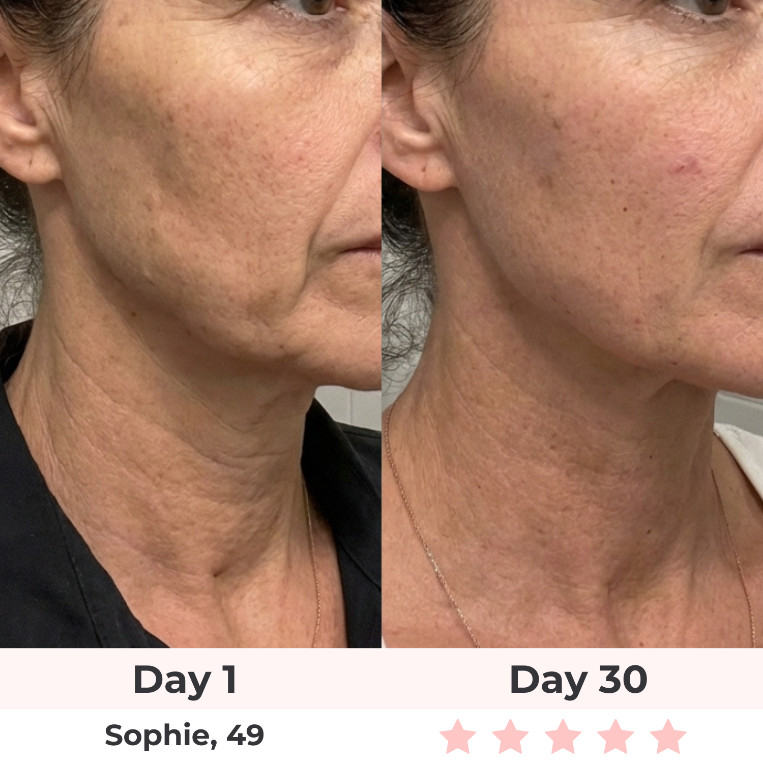 Orior LED Facial Sculptor