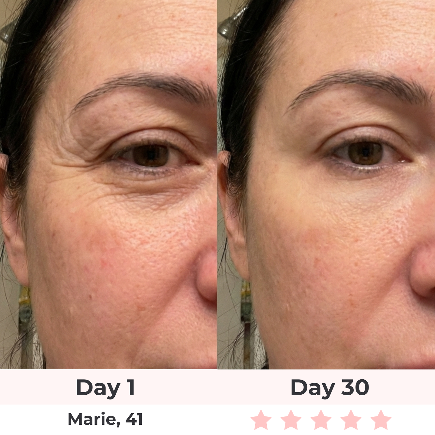 Orior LED Facial Sculptor